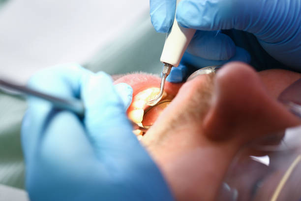 Best Walk-In Emergency Dentist in Fostoria, OH